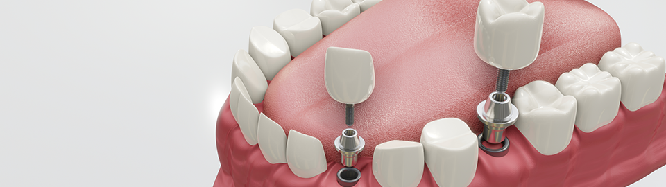 BAREUN WELL DENTAL CLINIC